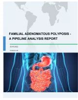 Familial Adenomatous Polyposis - A Pipeline Analysis Report